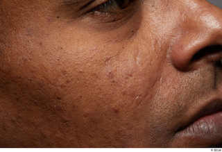 HD Face Skin Arris Cook cheek face nose skin pores…